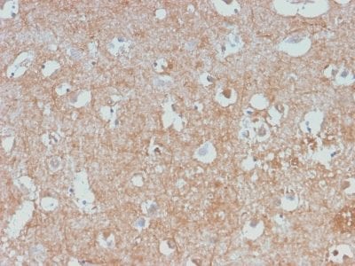 Formalin-fixed paraffin-embedded human Cerebellum stained with Neurofilament Rabbit Monoclonal Antibody (NEFL/2983R).
