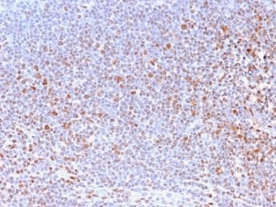 SDS-PAGE Analysis Purified Pan-Nuclear Antigen Monoclonal Antibody (NM2984R). Confirmation of Purity and Integrity of Antibody.