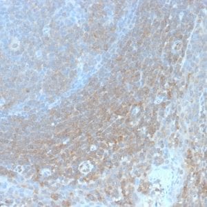 Formalin-fixed paraffin-embedded human Tonsil stained with BCL10 Recombinant Rabbit Monoclonal Antibody (BL10/2988R).