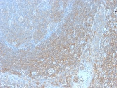 Formalin-fixed paraffin-embedded human Tonsil stained with BCL10 Recombinant Rabbit Monoclonal Antibody (BL10/2988R).