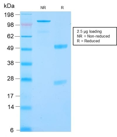 SDS-PAGE Analysis Purified RCC Rabbit Recombinant Monoclonal Antibody (CA9/2993R). Confirmation of Purity and Integrity of Antibody.