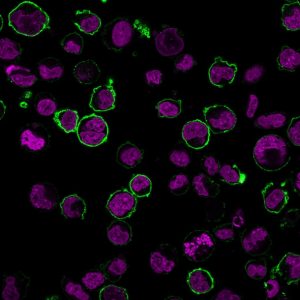 CD43 Recombinant Monoclonal Rabbit Antibody (SPN/2049R)