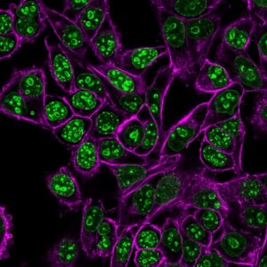 Ki-67 Monoclonal Mouse Antibody (MKI67/2462)