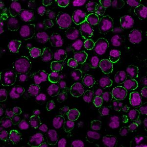 CD19 Monoclonal Mouse Antibody (CVID3/429)
