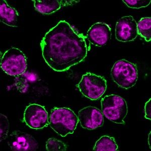 CD43 Recombinant Monoclonal Rabbit Antibody (SPN/1766R)