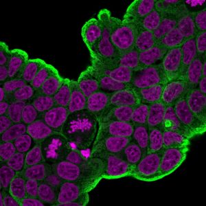 HSP27 Monoclonal Mouse Antibody (HSPB1/774)