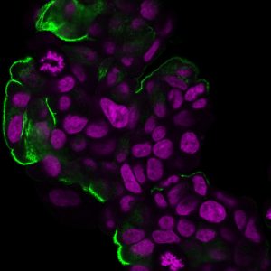 Mucin 1 / EMA / Episialin / CD227 Monoclonal Mouse Antibody (HMPV)