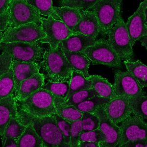 Moesin Monoclonal Mouse Antibody (MSN/493)