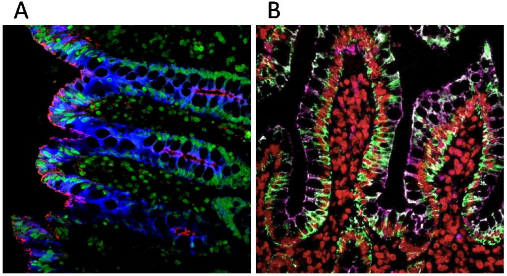 Tech Tip Multi Color Fluorescence Imaging Using Biotiums Tyramide Amplification Kits Biotium 