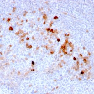 Endoglin / CD105 Monoclonal Mouse Antibody (ENG/3269)