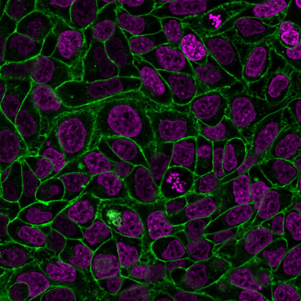 Cellbrite® Steady Membrane Staining Kits Biotium