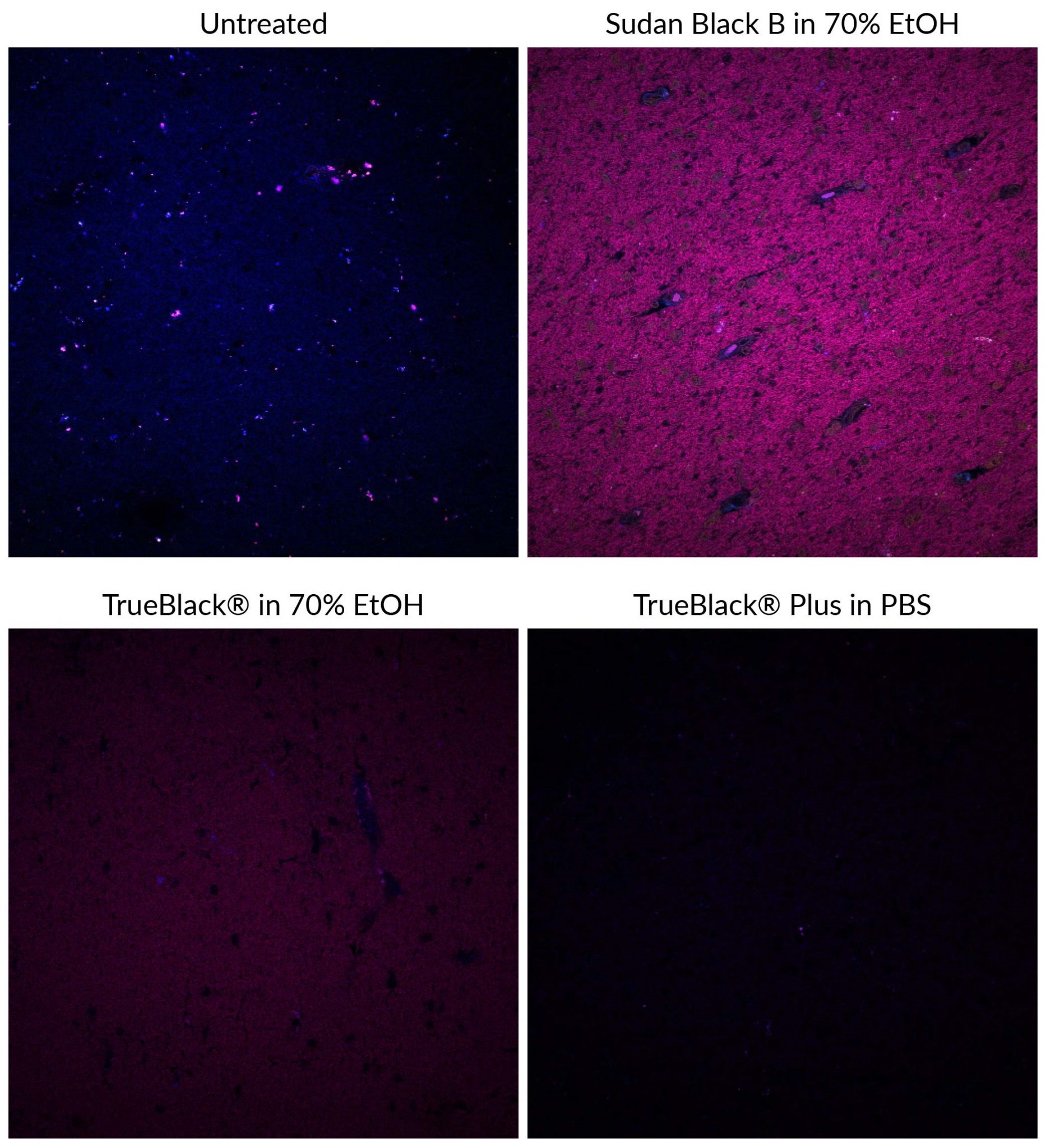 TrueBlack® Plus Lipofuscin Autofluorescence Quencher, 40X in DMSO - Biotium