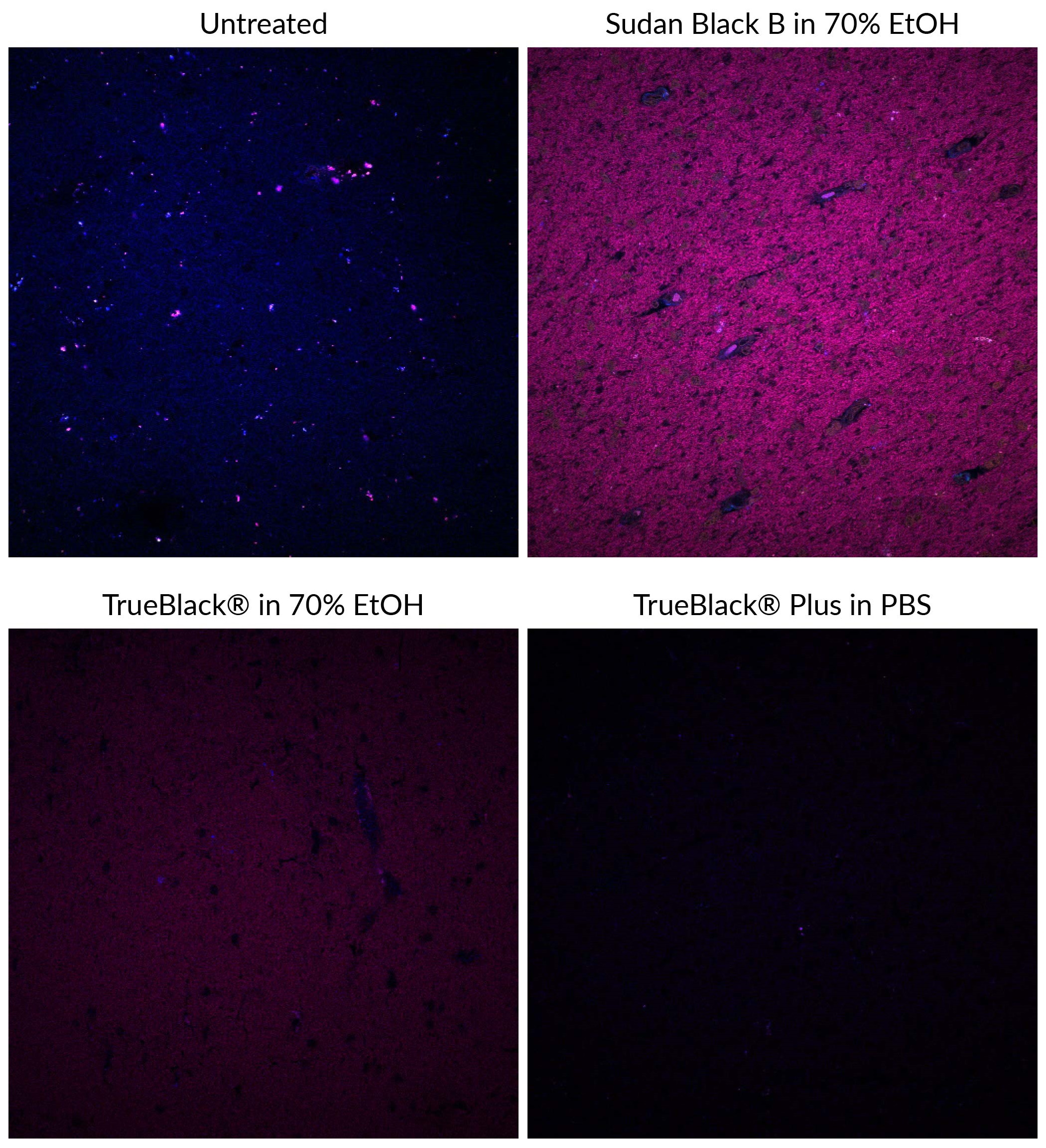 TrueBlack® Plus Lipofuscin Autofluorescence Quencher, 40X in DMSO ...