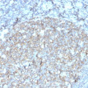 CD81 / TAPA-1 Recombinant Monoclonal Mouse Antibody (rC81/3442)