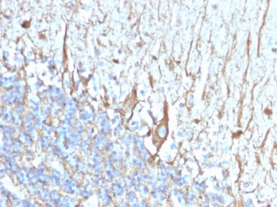 Formalin-fixed, paraffin-embedded human Cerebellum stained with Neurofilament Mouse Monoclonal Antibody (2F11).