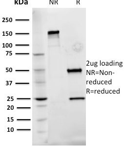 SDS-PAGE Analysis Purified Fibronectin Mouse Monoclonal Antibody (Fn-3). Confirmation of Integrity and Purity of Antibody.