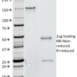 SDS-PAGE Analysis Purified IFNG Mouse Monoclonal Antibody (G-23). Confirmation of Purity and Integrity of Antibody.