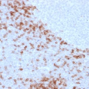 Formalin-fixed, paraffin-embedded human Lymph Node stained with IgD Mouse Monoclonal Antibody (IGD26).