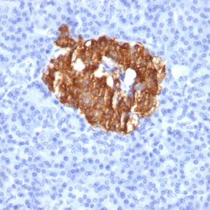 Formalin-fixed, paraffin-embedded human Pancreas stained with Insulin Monoclonal Antibody (K36aC10).