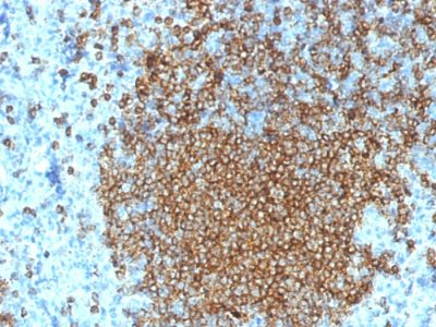 Formalin-fixed, paraffin-embedded human Spleen stained with CD45RA Mouse Monoclonal Antibody (K4B5).
