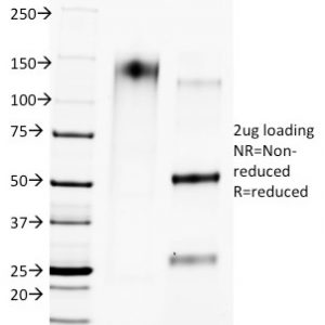 SDS-PAGE Analysis of Purified CTLA4 Mouse Monoclonal Antibody (L4P2F5.F10). Confirmation of Purity and Integrity of Antibody