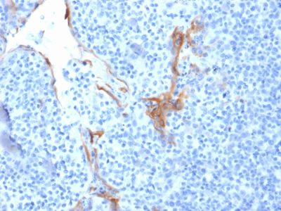 Formalin-fixed, paraffin-embedded human Tonsil stained with Cytokeratin 16 Mouse Monoclonal Antibody (LL025).