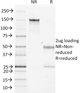 SDS-PAGE Analysis Purified MHC II Mouse Monoclonal Antibody (MK-D6). Confirmation of Purity and Integrity of Antibody.
