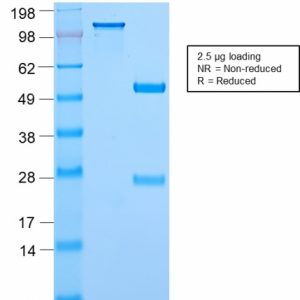 SDS-PAGE Analysis Purified c-Myc Rabbit Recombinant Monoclonal Antibody (MYC2895R). Confirmation of Purity and Integrity of Antibody.