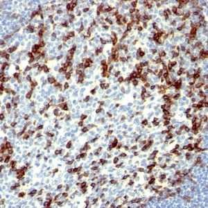 Formalin-fixed, paraffin-embedded human Tonsil stained with PD1 (CD279) Monoclonal Antibody (NAT105).