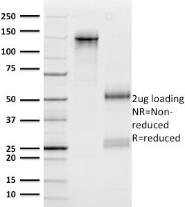 SDS-PAGE Analysis Purified n-Myc Mouse Monoclonal Antibody (NMYC-1). Confirmation of Purity and Integrity of Antibody.