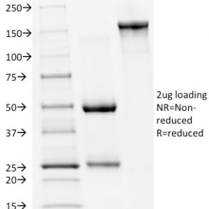 SDS-PAGE Analysis Purified p53 Mouse Monoclonal Antibody (PAb240). Confirmation of Integrity and Purity of Antibody.