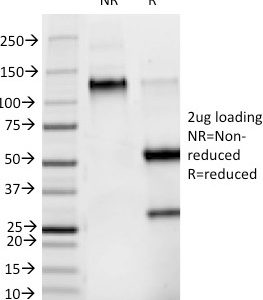 SDS-PAGE Analysis Purified Phosphotyrosine Mouse Monoclonal Antibody (PY265). Confirmation of Purity and Integrity of Antibody.