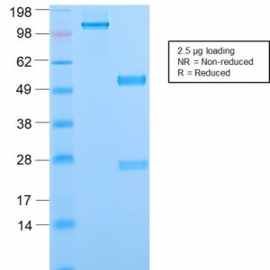SDS-PAGE Analysis Purified Phosphotyrosine Rabbit Recombinant Monoclonal Ab (PY2870R). Confirmation of Purity and Integrity of Antibody.