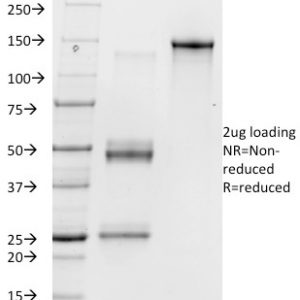 SDS-PAGE Analysis Purified Vitronectin Receptor Mouse Monoclonal Antibody (23C6). Confirmation of Purity and Integrity of Antibody.