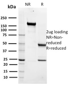 SDS-PAGE Analysis Purified Maltose Binding Protein Mouse Monoclonal Antibody (R29.6). Confirmation of Integrity and Purity of Antibody.