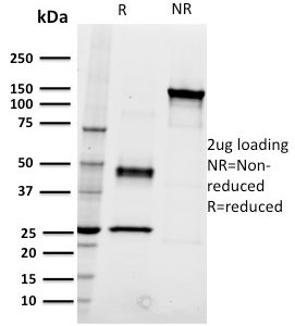 SDS-PAGE Analysis Purified CD22 Mouse Monoclonal Antibody (RFB4). Confirmation of Integrity and Purity of Antibody.