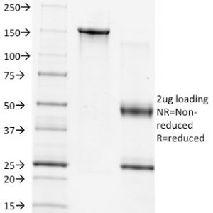 SDS-PAGE Analysis of Purified TIMP1 Mouse Monoclonal Antibody (2A5). Confirmation of Integrity and Purity of Antibody.