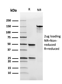 SDS-PAGE Analysis Purified IgA Recombinant Mouse Monoclonal Antibody (rHISA43). Confirmation of Purity and Integrity of Antibody.