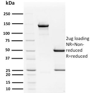 SDS-PAGE Analysis Purified Mouse Monoclonal Antibody HPV16 E2 (Human Papilloma Virus 16). Confirmation of Purity and Integrity of Antibody.