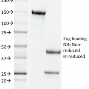 SDS-PAGE Analysis Purified CD44v4 Mouse Monoclonal Antibody (2F10). Confirmation of Purity and Integrity of Antibody.