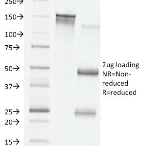 SDS-PAGE Analysis Purified VEGF Mouse Monoclonal Antibody (VG76e). Confirmation of Integrity and Purity of Antibody.