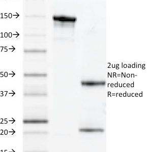 SDS-PAGE Analysis Purified MUC1 Mouse Monoclonal Antibody (VU-11D1). Confirmation of Integrity and Purity of Antibody.