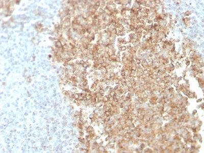 Formalin-fixed, paraffin-embedded normal human spleen tissue stained with CDw75 Mouse Monoclonal Antibody (ZB55).