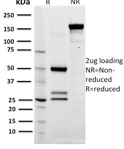 SDS-PAGE Analysis Purified CD79a Mouse Monoclonal Antibody (ZL7-4). Confirmation of Integrity and Purity of Antibody.