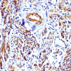 Formalin-fixed, paraffin-embedded human Uterus stained with Caldesmon Rabbit Polyclonal Antibody.