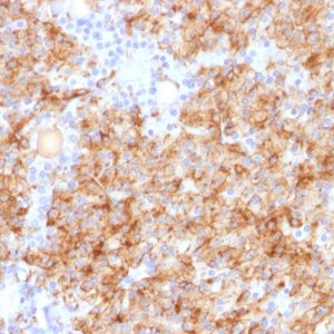 Formalin-fixed, paraffin-embedded human Parathyroid stained with Chromogranin A Rabbit Polyclonal Antibody.