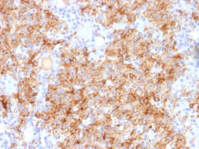 Formalin-fixed, paraffin-embedded human Parathyroid stained with Chromogranin A Rabbit Polyclonal Antibody.