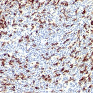 Formalin-fixed, paraffin-embedded human Tonsil stained with PD1 (CD279) Rabbit Polyclonal Antibody.