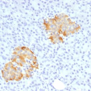 Formalin-fixed, paraffin-embedded human Pancreas stained with TNF alpha Rabbit Polyclonal Antibody.