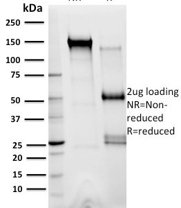 SDS-PAGE Analysis Purified XRCC3 Mouse Monoclonal Antibody (10F1/6). Confirmation of Integrity and Purity of Antibody.